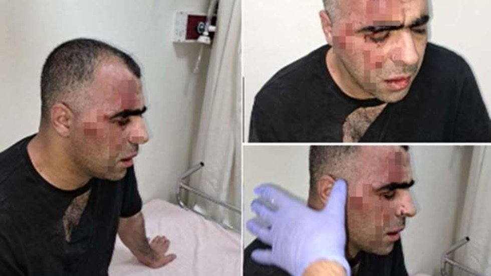 Saldırıya uğrayan gazeteci Sinan Ayg&uuml;l yeniden hastaneye kaldırıldı