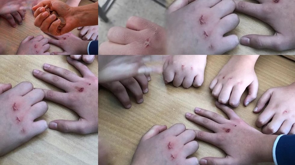 'Kanlı para' oyunu yayılıyor: Kemikleri &ccedil;atlatıyor, elleri kan i&ccedil;inde bırakıyor&hellip;