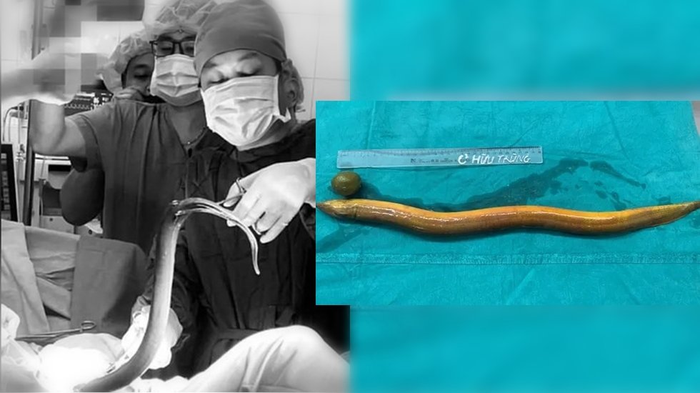 Karnından çıkan, doktorları bile şaşırttı!