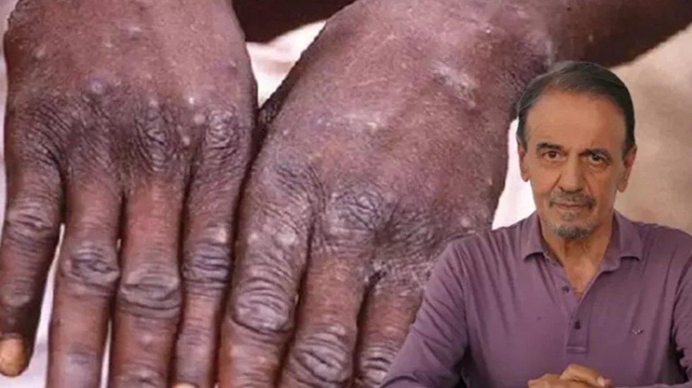 Mehmet Ceyhan&rsquo;dan &lsquo;maymun &ccedil;i&ccedil;eği&rsquo; uyarısı&hellip;