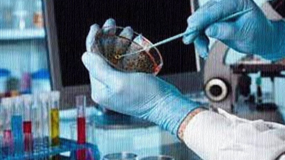 Salgın hastalıkların kapısı a&ccedil;ık tutuluyor. Port&ouml;r testi zorunlu olmalıdır...