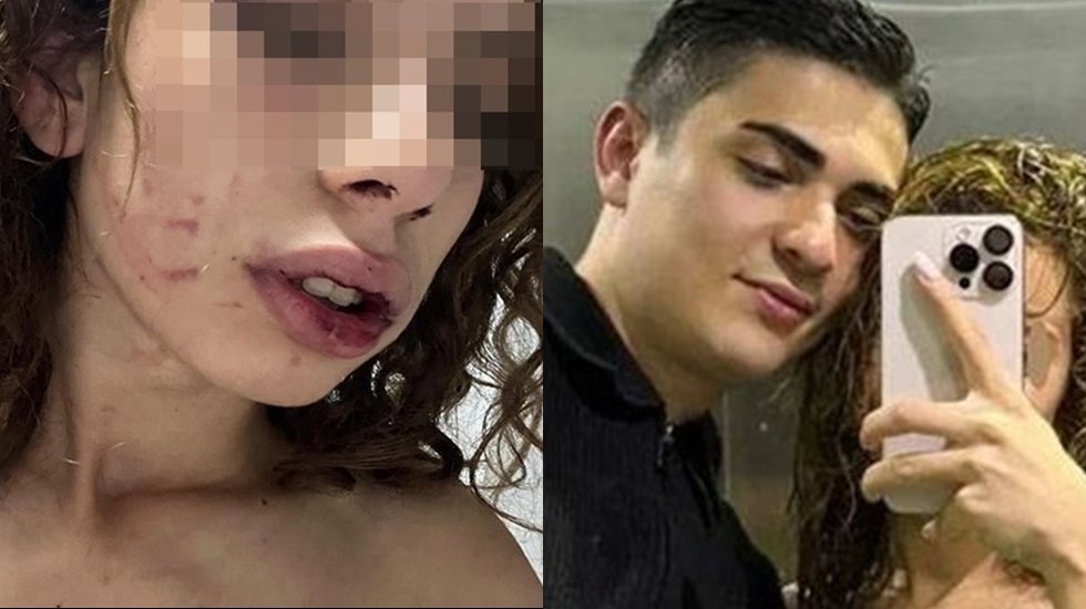 Ayrılmak isteyen 19 yaşındaki kadına işkence yapan şahıs adli kontrol şartıyla serbest bırakıldı