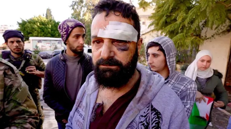 CHP&rsquo;li Dr. Şevkin: &ldquo;Lazkiye ve Tartus&rsquo;taki Aleviler can g&uuml;venliği kaygısı yaşıyor&rdquo;