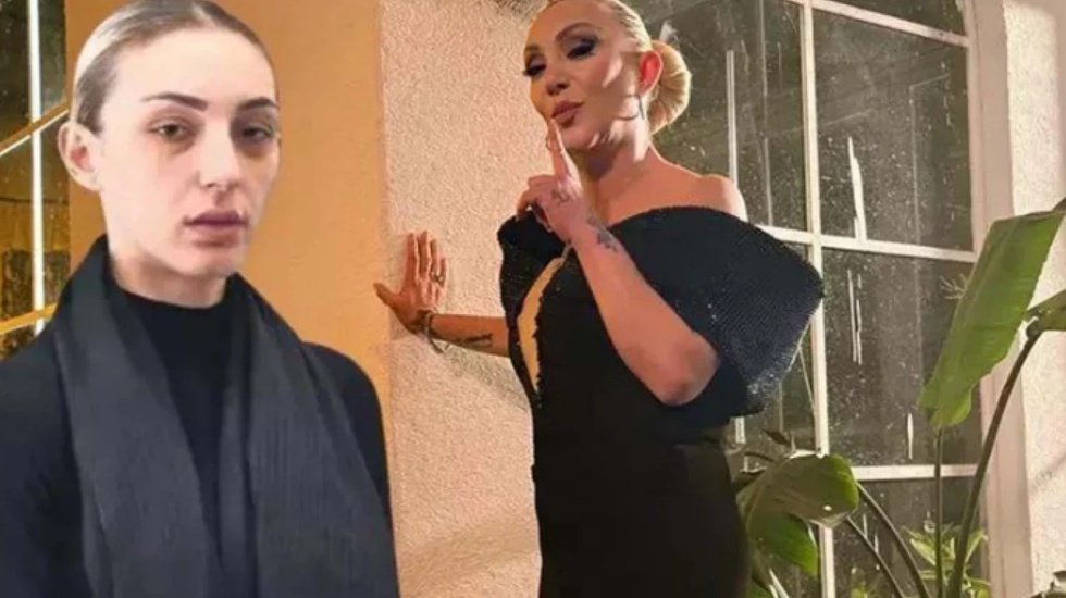 G&uuml;ll&uuml;'n&uuml;n &ouml;l&uuml;m&uuml;nde kritik gelişme!