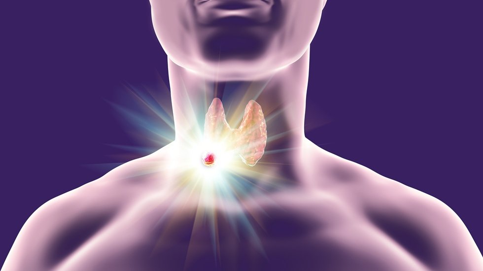 Yalancı nod&uuml;ller kanser zannedilip ameliyata gidilebiliyor